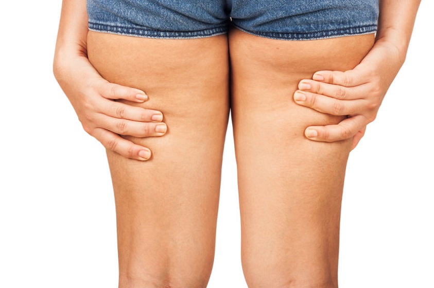 Consejos para combatir la celulitis o piel de naranja