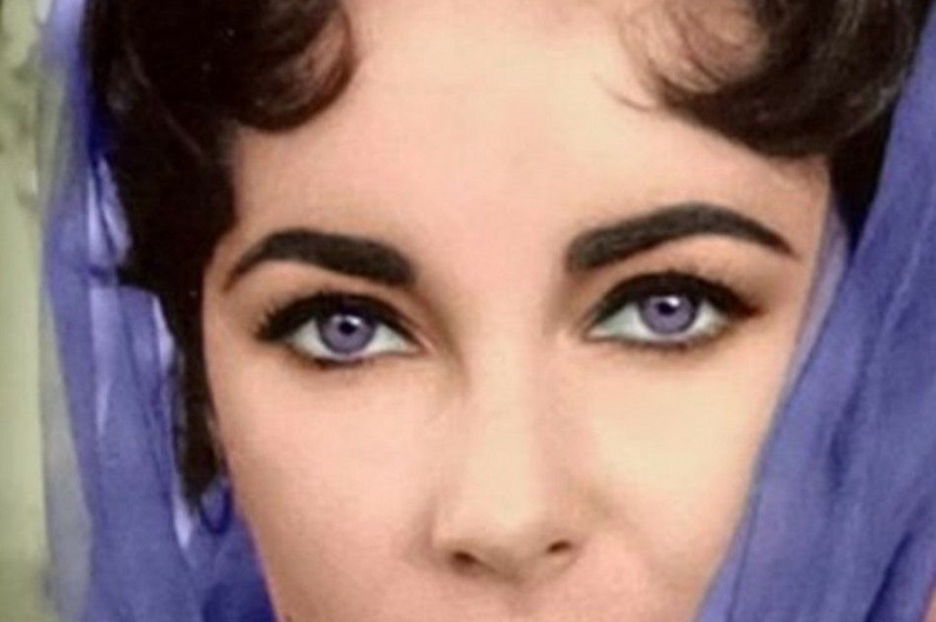 El síndrome de Alejandría: la condición de los ojos violeta
