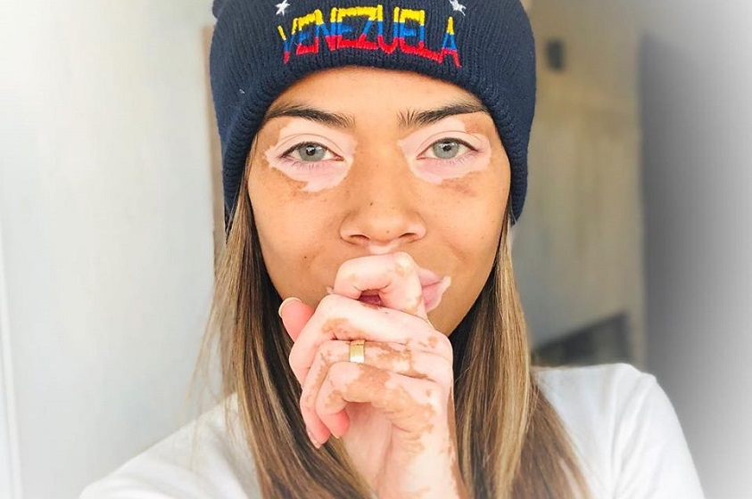 Maquillaje para tapar manchas de la cara
